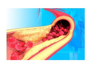 Rosuvastatin: a medicine to treat high cholesterol - Galnewa