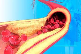 rosuvastatin-a-medicine-to-treat-high-cholesterol-galnewa-big-0