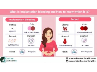 What is Implantation Bleeding and Period Bleeding? - Dallas